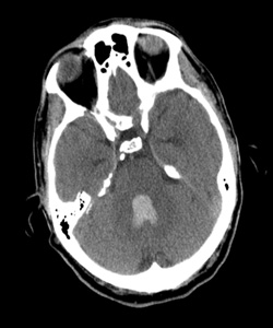 Further imaging recommendations